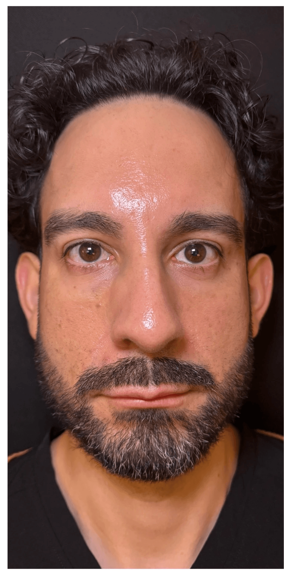 Armonía facial — Antes