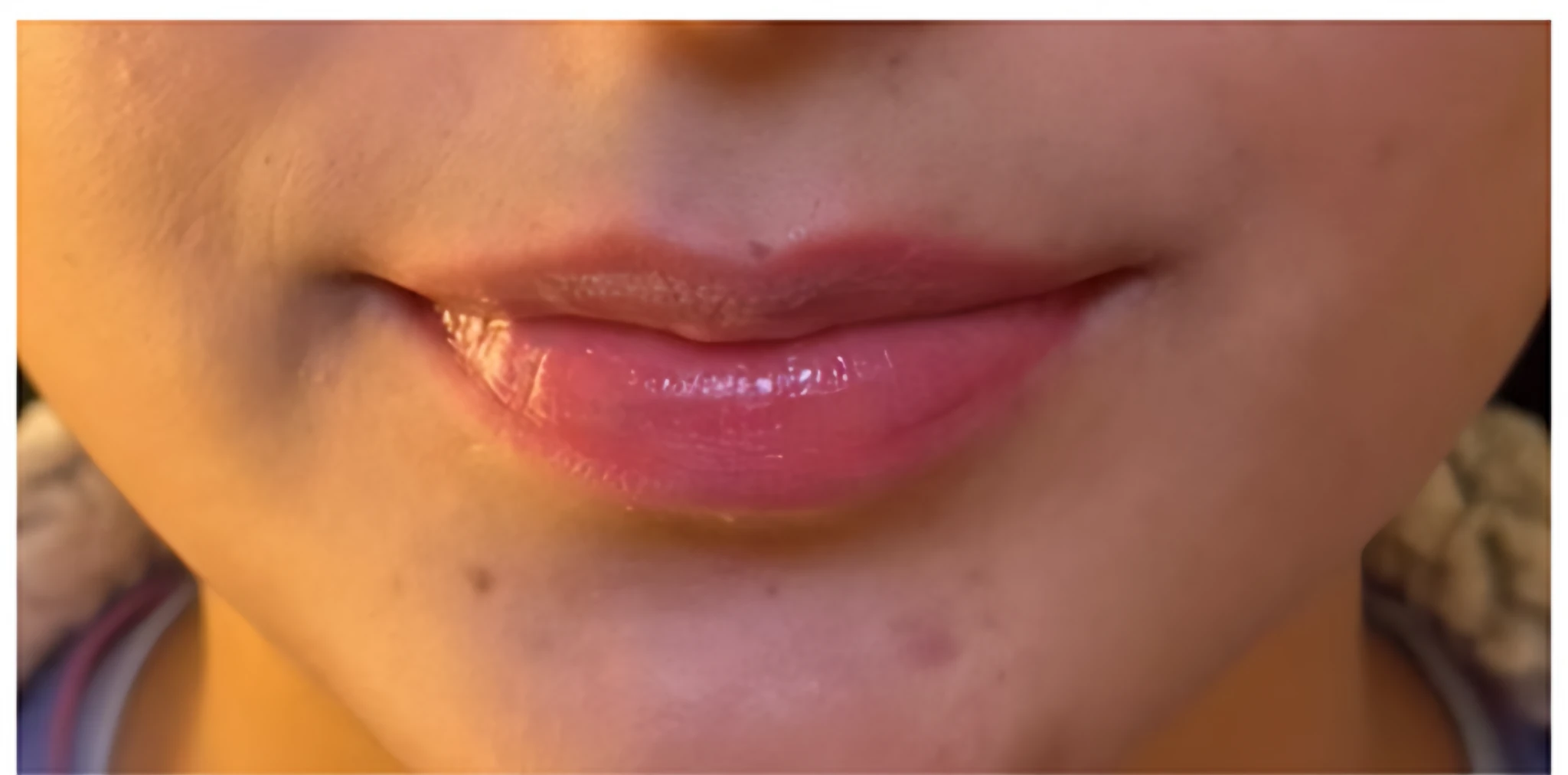 Realce de labios — Antes