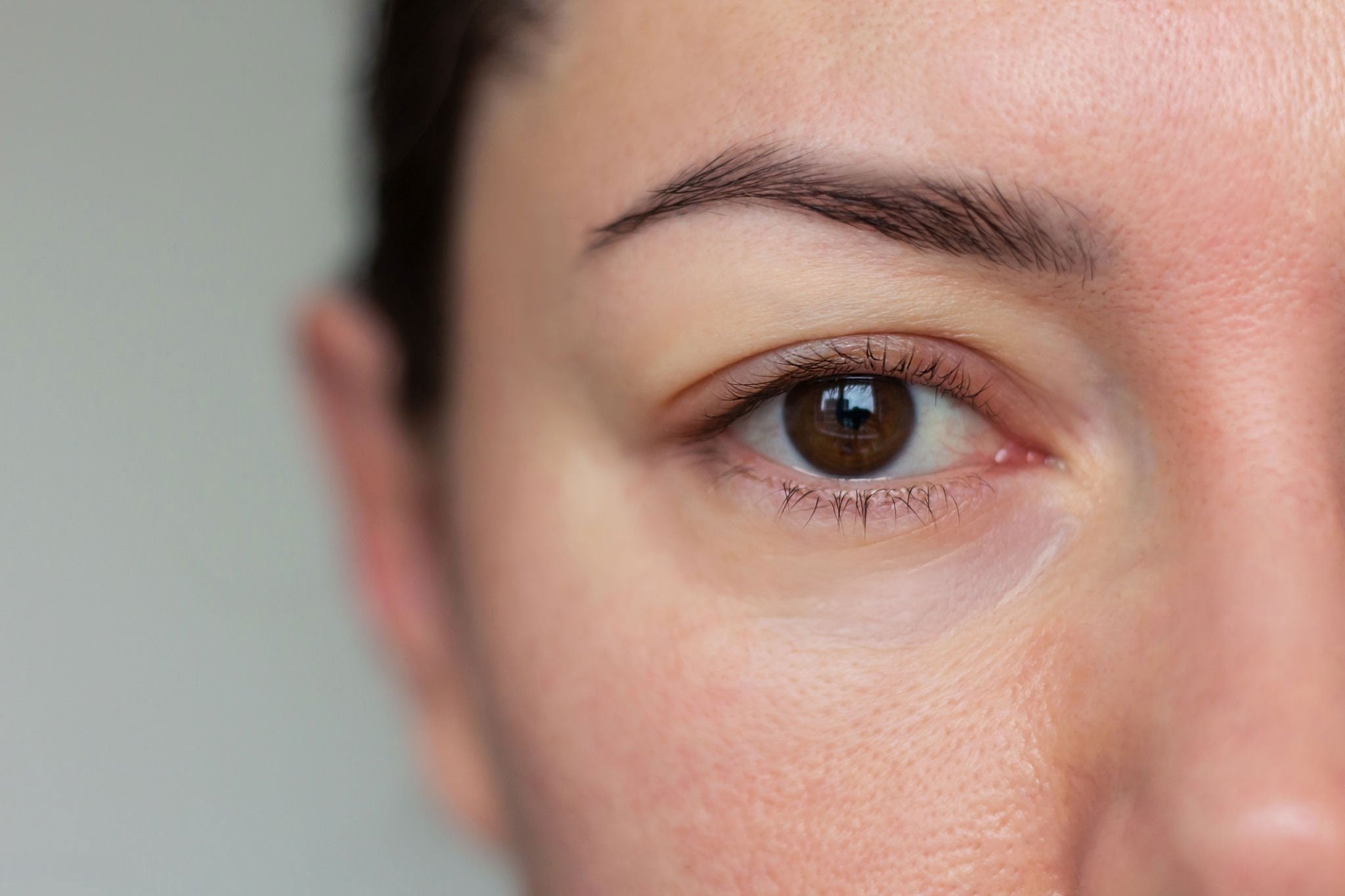Primer plano del ojo y la mejilla de una mujer, con la textura de la piel